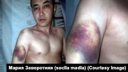 Бишкектеги №1 тергөө абагында отурган Эмилбек Кимсанов сабалды делген сүрөтү (Сүрөт Кимсановдун аялы Мария Заворотняянын "Фейсбук" баракчасынан алынды).